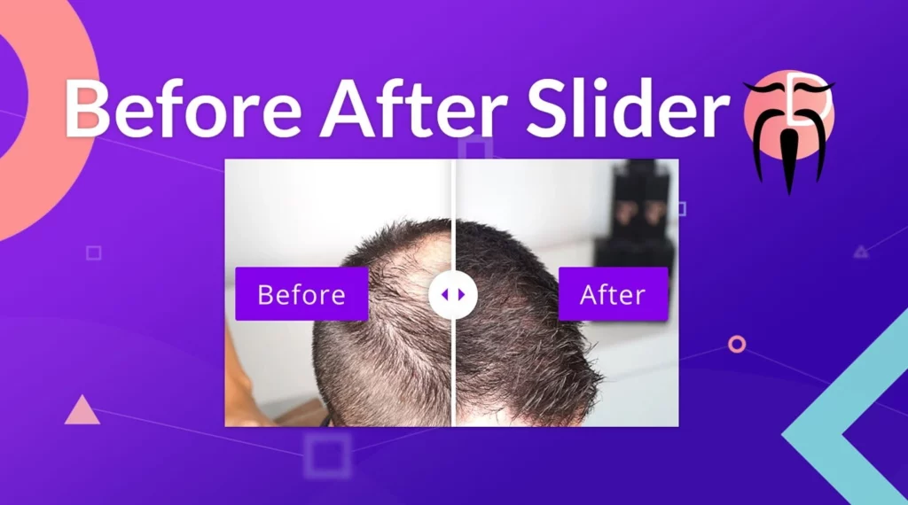 Divi Sensei Before After Slider 2.2.2